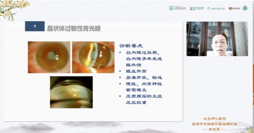 北京同仁眼科 联会 暨同仁眼科论坛2020年秋季临床病例讨论会