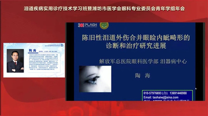 国家级继续医学教育项目 | 泪道疾病实用诊疗技术学习班暨潍坊市医学会眼科专业委员会青年学组年会精彩回顾